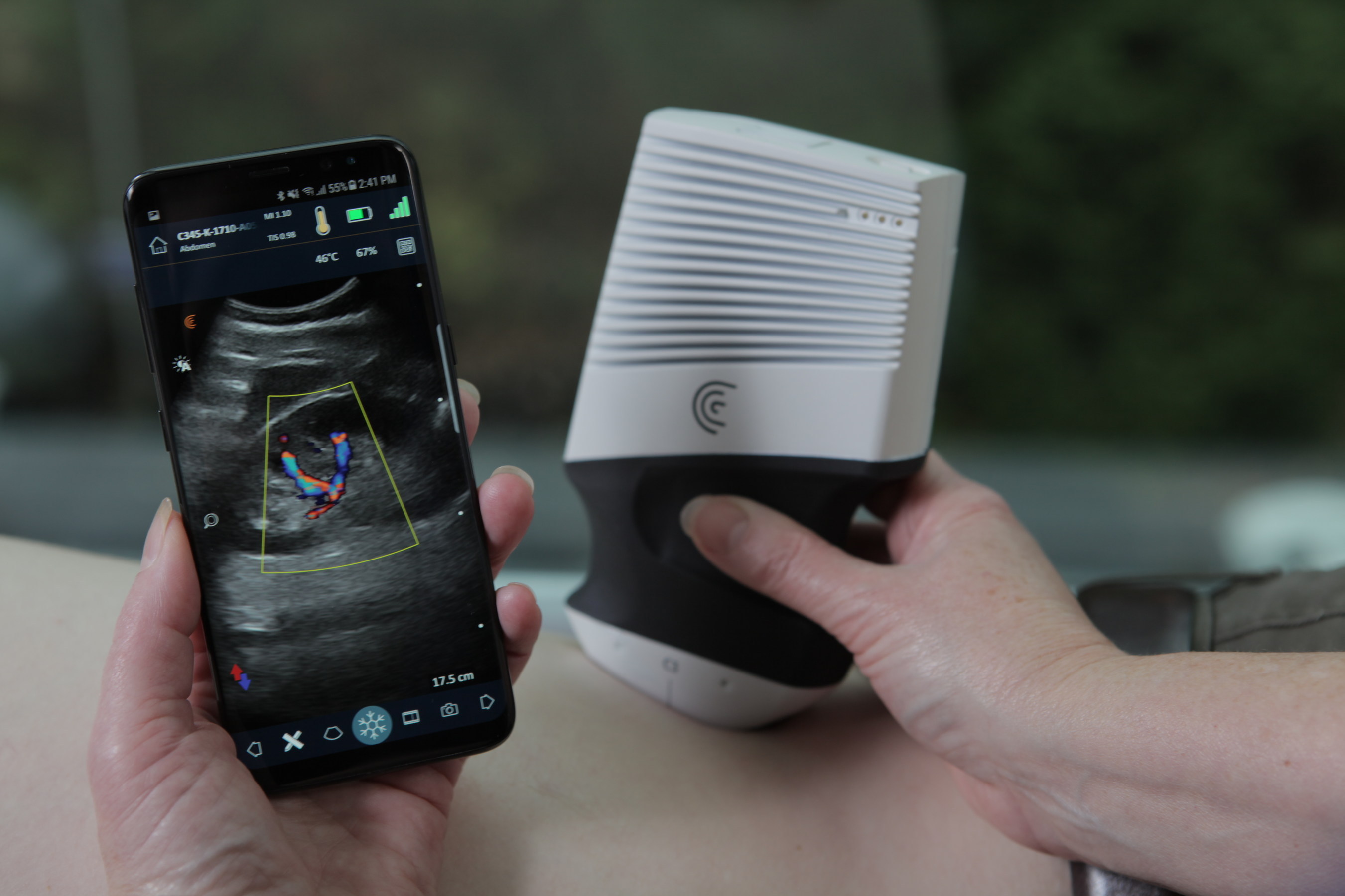 BCIT Alumnus-developed Portable Ultrasound Device Uses Home-grown ...